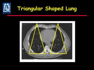 Triangular Shaped Lung Denver Health 