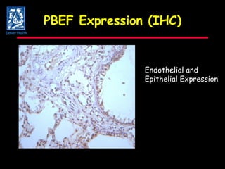 PBEF Expression (IHC) Endothelial and Epithelial Expression Denver Health 20x 
