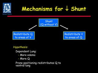 Mechanisms for    Shunt Hypothesis: Dependent Lung: -  More edema -  More Q Prone positioning redistributes Q to  ventral lung Shunt (Q without V) Redistribute Q to areas of V Redistribute V to areas of Q Denver Health 