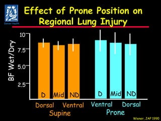Effect of Prone Position on Regional Lung Injury Supine 10 7.5 5.0 2.5 BF Wet/Dry Dorsal Ventral Wiener, JAP 1990 D Mid ND D Mid ND Prone Dorsal Ventral Denver Health 
