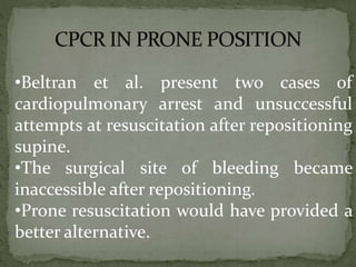 Prone CPR is performed frequently in the operating
room (OR) on patients
• Spine surgeries- deformity corrections
• Neuros...