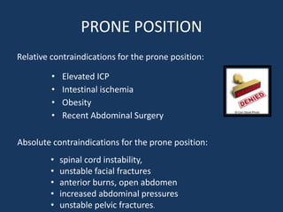 PRONE POSITION
Relative contraindications for the prone position:
• Elevated ICP
• Intestinal ischemia
• Obesity
• Recent Abdominal Surgery
Absolute contraindications for the prone position:
• spinal cord instability,
• unstable facial fractures
• anterior burns, open abdomen
• increased abdominal pressures
• unstable pelvic fractures.
 