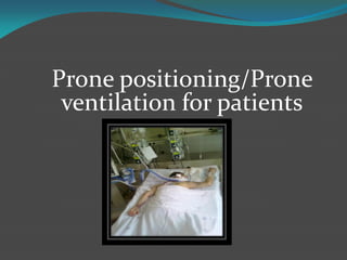Prone positioning/Prone
ventilation for patients
 