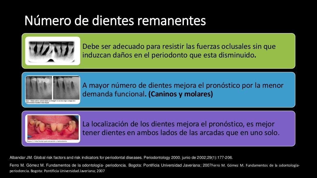 Pronostico y plan de tratamiento Periodontal