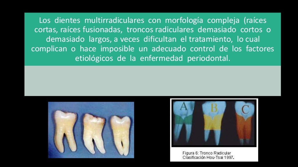 Pronostico y plan de tratamiento Periodontal