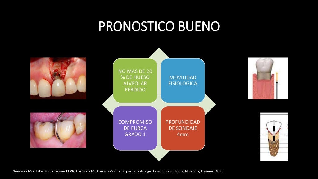 Pronostico y plan de tratamiento Periodontal