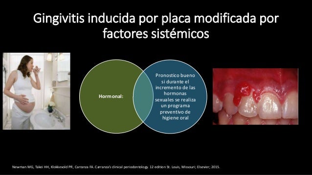 Pronostico y plan de tratamiento Periodontal Pronostico y plan de tratamiento Periodontal