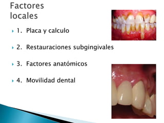  1. Placa y calculo
 2. Restauraciones subgingivales
 3. Factores anatómicos
 4. Movilidad dental
 