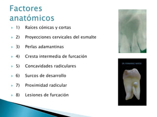  1) Raíces cónicas y cortas
 2) Proyecciones cervicales del esmalte
 3) Perlas adamantinas
 4) Cresta intermedia de furcación
 5) Concavidades radiculares
 6) Surcos de desarrollo
 7) Proximidad radicular
 8) Lesiones de furcación
 