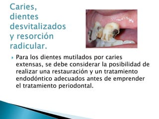  Para los dientes mutilados por caries
extensas, se debe considerar la posibilidad de
realizar una restauración y un tratamiento
endodóntico adecuados antes de emprender
el tratamiento periodontal.
 