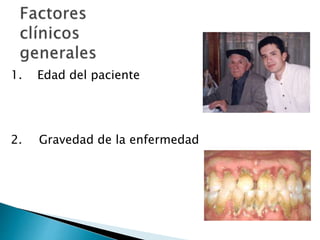 1. Edad del paciente
2. Gravedad de la enfermedad
 