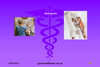 Mamografía




04/03/2011   jquintanam@unmsm.edu.pe   20
 