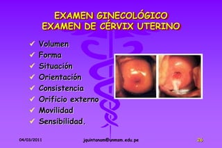 EXAMEN GINECOLÓGICO
         EXAMEN DE CÉRVIX UTERINO
     Volumen
     Forma
     Situación
     Orientación
     Consistencia
     Orificio externo
     Movilidad
     Sensibilidad.

04/03/2011          jquintanam@unmsm.edu.pe   26
 