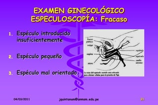 EXAMEN GINECOLÓGICO
                  ESPECULOSCOPÍA: Fracaso
1.    Espéculo introducido
      insuficientemente

2.    Espéculo pequeño


3.    Espéculo mal orientado.



     04/03/2011         jquintanam@unmsm.edu.pe   31
 