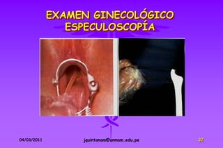 EXAMEN GINECOLÓGICO
                ESPECULOSCOPÍA




04/03/2011        jquintanam@unmsm.edu.pe   32
 