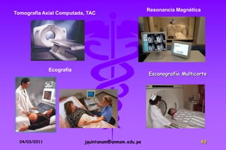 Resonancia Magnética
Tomografía Axial Computada, TAC




               Ecografia
                                                     Escanografía Multicorte




  04/03/2011               jquintanam@unmsm.edu.pe                          43
 
