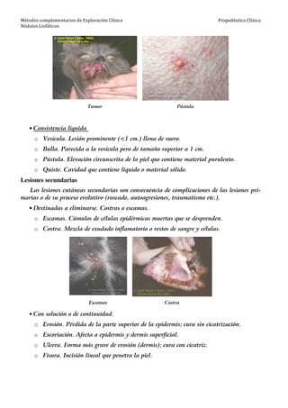Métodos complementarios de Exploración Clínica
Nódulos Linfáticos
Propedéutica Clínica
Tumor Pústula
• Consistencia líquida
o Vesícula. Lesión prominente (<1 cm.) llena de suero.
o Bulla. Parecida a la vesícula pero de tamaño superior a 1 cm.
o Pústula. Elevación circunscrita de la piel que contiene material purulento.
o Quiste. Cavidad que contiene líquido o material sólido.
Lesiones secundarias
Las lesiones cutáneas secundarias son consecuencia de complicaciones de las lesiones pri-
marias o de su proceso evolutivo (rascado, autoagresiones, traumatismo etc.).
• Destinadas a eliminarse. Costras o escamas.
o Escamas. Cúmulos de células epidérmicas muertas que se desprenden.
o Costra. Mezcla de exudado inflamatorio o restos de sangre y células.
Escamas Costra
• Con solución o de continuidad.
o Erosión. Pérdida de la parte superior de la epidermis; cura sin cicatrización.
o Excoriación. Afecta a epidermis y dermis superficial.
o Ulcera. Forma más grave de erosión (dermis); cura con cicatriz.
o Fisura. Incisión lineal que penetra la piel.
 