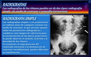 RADIOGRAFIAS
Las radiografías de los riñones pueden ser de dos tipos: radiografía
simple, sin medio de contraste y urografía intravenosa.
RADIOGRAFIASIMPLE
Las radiografías simples o sin preparación
se realizan antes de cualquier examen con
medio de contraste, lo que permite ajustar
todos los parámetros radiográficos y
establecer una imagen de referencia para
la interpretación de las placas posteriores.
Se puede observar el tamaño, la forma y la
densidad de los riñones.
En ocasiones, la superposición del
contenido intestinal o la disminución de
contraste intrabdominal, pueden dificultar
su visualización.
 