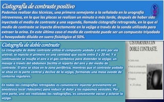 Cistografíade doblecontraste
La cistografía de doble contraste utiliza el compuesto yodado y el aire por vía
uretral; se inyecta el primero en una cantidad que oscila entre 2 y 20 ml. Y a
continuación se insufla el aire o el gas carbónico para distender la vejiga; un
masaje a través del abdomen facilita el reparto del aire y del medio de
contraste. El aire se sitúa en la zona periférica, mientras que el contraste yodado
se sitúa en la parte central y declive de la vejiga, formando una masa ovoide de
contorno regulares.
En todas las cistografías retrogadas es conveniente inyectar previamente un
anestésico local (lidocaina) para reducir el dolor y los espasmos vesicales. Por
otra parte, una vez realizadas las radiografías, es conveniente vaciar y aclarar la
vejiga.
Cistografíade contrastepositivo
Podemos realizar dos técnicas, una primera semejante a la señalada en la urografía
intravenosa, en la que las placas se realizan un minuto o más tarde, después de haber sido
inyectado el medio de contraste y una segunda, llamada cistografía retrograda, en la que el
medio de contraste se inyecta directamente en la vejiga a través de la sonda utilizada para
extraer la orina. En este último caso el medio de contraste puede ser un compuesto triyodado
o hexayodado diluido en suero fisiológico al 50%.
 