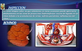 INSPECCION:
No tiene ningún valor, ya que solamente en raras ocasiones puede apreciarse
abultamiento en las zona de proyección (hidronefrosis: exceso de líquido en un
riñón debido a la acumulación de orina, nefritis purulenta: inflamación del
riñón.)
 