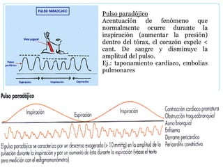 Pulso paradójico   Acentuación de fenómeno que normalmente ocurre durante la inspiración (aumentar la presión) dentro del tórax, el corazón expele < cant. De sangre y disminuye la amplitud del pulso.  Ej.: taponamiento cardíaco, embolias pulmonares 