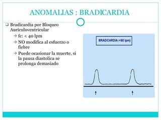 ANOMALIAS : BRADICARDIA  Bradicardia por Bloqueo Auriculoventricular fc: < 40 lpm NO modifica al esfuerzo o fiebre Puede ocasionar la muerte, si la pausa diastolica se prolonga demasiado 