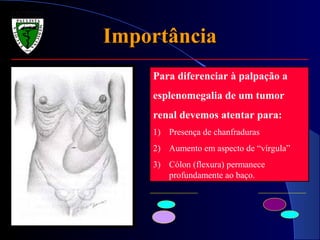 Para diferenciar à palpação a
esplenomegalia de um tumor
renal devemos atentar para:
1) Presença de chanfraduras
2) Aumento em aspecto de “vírgula”
3) Cólon (flexura) permanece
profundamente ao baço.
ImportânciaImportância
 