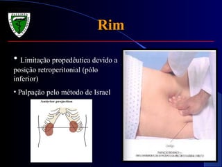 RimRim
• Limitação propedêutica devido a
posição retroperitonial (pólo
inferior)
• Palpação pelo método de Israel
 