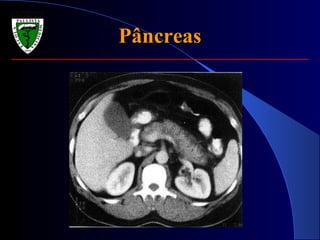 PâncreasPâncreas
 
