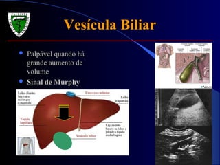 Vesícula BiliarVesícula Biliar
 Palpável quando háPalpável quando há
grande aumento degrande aumento de
volumevolume
 Sinal de MurphySinal de Murphy
 