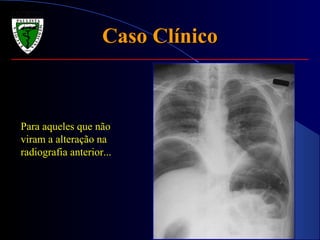Caso ClínicoCaso Clínico
Para aqueles que não
viram a alteração na
radiografia anterior...
 