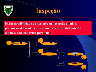 InspeçãoInspeção
Existe possibilidade de apenas com inspeção aliada àExiste possibilidade de apenas com inspeção aliada à
percussão, determinar se um tumor é intra-abdominal epercussão, determinar se um tumor é intra-abdominal e
ainda se é ou não retro-peritonial.ainda se é ou não retro-peritonial.
 