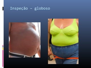 Inspeção – globoso 
 