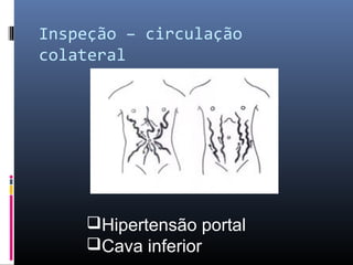 Inspeção – circulação 
colateral 
Hipertensão portal 
Cava inferior 
 