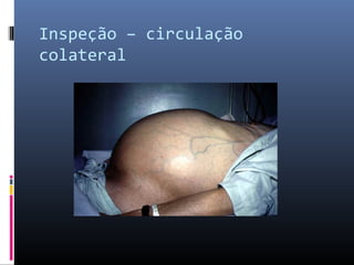 Inspeção – circulação 
colateral 
 