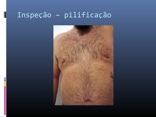 Inspeção – pilificação 
 