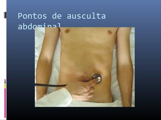 Pontos de ausculta 
abdominal 
 