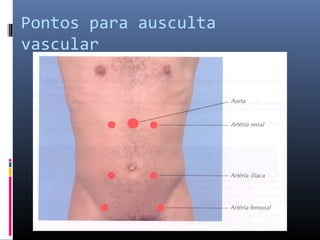 Pontos para ausculta 
vascular 
 