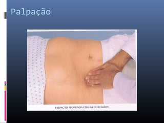 Palpação 
 