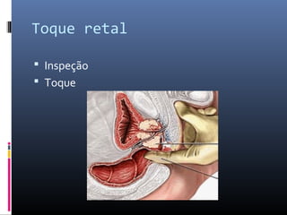 Toque retal 
 Inspeção 
 Toque 
 