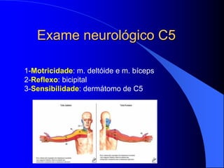Exame neurológico C5
1-Motricidade: m. deltóide e m. bíceps
2-Reflexo: bicipital
3-Sensibilidade: dermátomo de C5
 