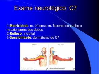 Exame neurológico C7
1-Motricidade: m. tríceps e m. flexores do punho e
m.extensores dos dedos
2-Reflexo: tricipital
3-Sensibilidade: dermátomo de C7
 