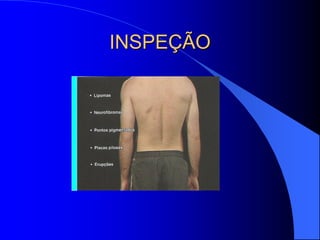 INSPEÇÃO
 