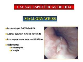 MALLORY WEISS
Responde por 5-10% das HDA
Apenas 30% tem história de vômito
Para espontaneamente em 80-90% xs
Tratamento:
Endoscópico
Cirurgia
CAUSAS ESPECĺFICAS DE HDA
 