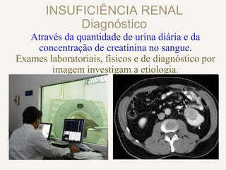 INSUFICIÊNCIA RENAL
Diagnóstico
Através da quantidade de urina diária e da
concentração de creatinina no sangue.
Exames laboratoriais, físicos e de diagnóstico por
imagem investigam a etiologia.
 