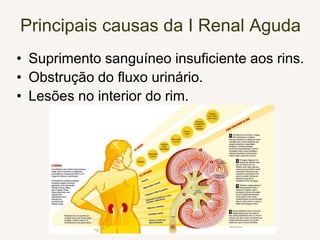 Principais causas da I Renal Aguda
• Suprimento sanguíneo insuficiente aos rins.
• Obstrução do fluxo urinário.
• Lesões no interior do rim.
 