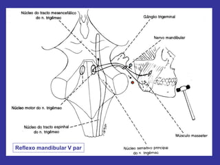 Reflexo mandibular V par
 