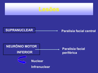 Lesões
SUPRANUCLEAR
NEURÔNIO MOTOR
INFERIOR
Paralisia facial central
Paralisia facial
periférica
Nuclear
Infranuclear
 