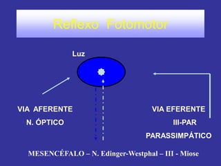 Reflexo Fotomotor
VIA AFERENTE
N. ÓPTICO
VIA EFERENTE
III-PAR
PARASSIMPÁTICO
MESENCÉFALO – N. Edinger-Westphal – III - Miose
Luz
 