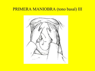PRIMERA MANIOBRA (tono basal) III 